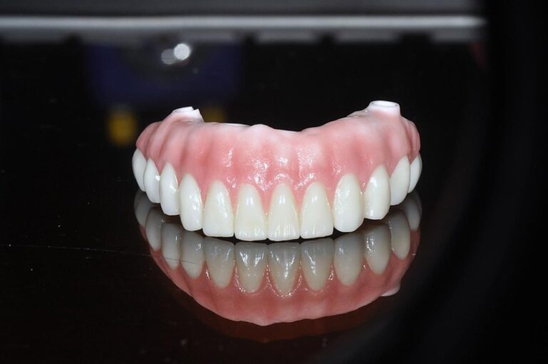 dental zirconia veneer restoration cases 768x510