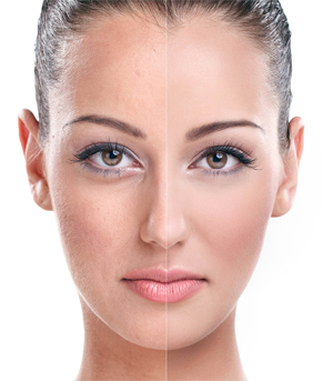 cosmetic procedure before after